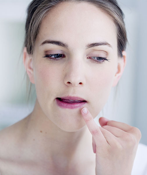 Prodromalphase von Herpes: Frau ahnt, dass sich der Lippenherpes bemerkbar macht.